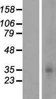 OR5F1 (NM_003697) Human Tagged ORF Clone