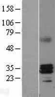 RNase H1(RNASEH1) (NM_002936) Human Tagged ORF Clone