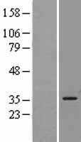 Heme Oxygenase 1(HMOX1) (NM_002133) Human Tagged ORF Clone