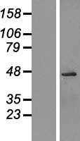 OGG1(OGG1) (NM_016821) Human Tagged ORF Clone