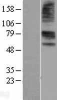 SLC22A6 (NM_153276) Human Tagged ORF Clone
