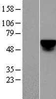 KLF4 (NM_004235) Human Tagged ORF Clone