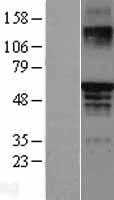 Estrogen Receptor beta(ESR2) (NM_001437) Human Tagged ORF Clone