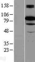 B Raf(BRAF) (NM_004333) Human Tagged ORF Clone