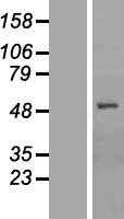 OATP2(SLCO1B1) (NM_006446) Human Tagged ORF Clone