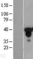 FOXA1 (NM_004496) Human Tagged ORF Clone