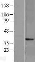 GLP1R (NM_002062) Human Tagged ORF Clone