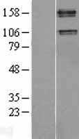IGF1 Receptor(IGF1R) (NM_000875) Human Tagged ORF Clone