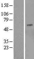 OSBPL9 (NM_148904) Human Tagged ORF Clone