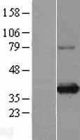 SIX1 (NM_005982) Human Tagged ORF Clone