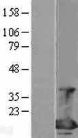 EIF4EBP1(EIF4EBP1) (NM_004095) Human Tagged ORF Clone