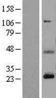 CD3E (NM_000733) Human Tagged ORF Clone