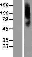 SLC22A8 (NM_004254) Human Tagged ORF Clone