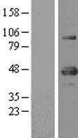 YY1 (NM_003403) Human Tagged ORF Clone
