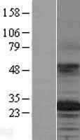 TSPAN12 (NM_012338) Human Tagged ORF Clone