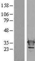 Galectin 3(LGALS3) (NM_002306) Human Tagged ORF Clone