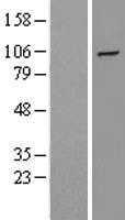 HIF 2 alpha(EPAS1) (NM_001430) Human Tagged ORF Clone