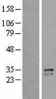 CD40L(CD40LG) (NM_000074) Human Tagged ORF Clone