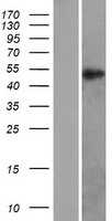 Retinoid X Receptor alpha(RXRA) (NM_002957) Human Tagged ORF Clone