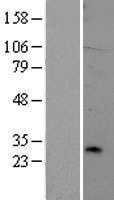 TREM2 (NM_018965) Human Tagged ORF Clone
