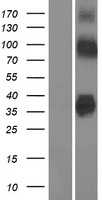 Zinc transporter 8(SLC30A8) (NM_173851) Human Tagged ORF Clone