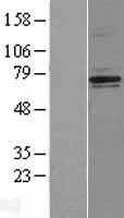 NF2 (NM_000268) Human Tagged ORF Clone