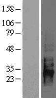 CD83 (NM_004233) Human Tagged ORF Clone