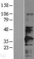 CD147(BSG) (NM_198589) Human Tagged ORF Clone