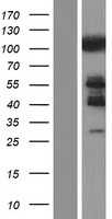 CBL(CBL) (NM_005188) Human Tagged ORF Clone