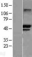 TRIM21 (NM_003141) Human Tagged ORF Clone