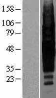 Rhodopsin(RHO) (NM_000539) Human Tagged ORF Clone