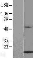 IL21 (NM_021803) Human Tagged ORF Clone