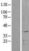 MC1 Receptor(MC1R) (NM_002386) Human Tagged ORF Clone
