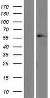 Vimentin(VIM) (NM_003380) Human Tagged ORF Clone