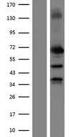 MMP2 (NM_004530) Human Tagged ORF Clone