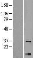 XBP1 (NM_005080) Human Tagged ORF Clone