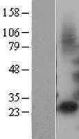 IGFBP1 (NM_000596) Human Tagged ORF Clone