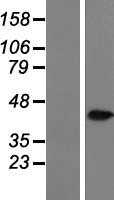 AKR1C3 (NM_003739) Human Tagged ORF Clone