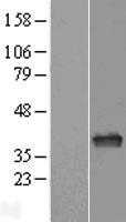 APE1(APEX1) (NM_080648) Human Tagged ORF Clone