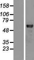 Rel B(RELB) (NM_006509) Human Tagged ORF Clone