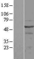 OSBPL2 (NM_144498) Human Tagged ORF Clone