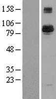 BAP1 (NM_004656) Human Tagged ORF Clone