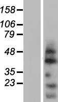 OVOL2 (NM_021220) Human Tagged ORF Clone