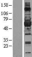 Glucose 6 Phosphate Dehydrogenase(G6PD) (NM_000402) Human Tagged ORF Clone