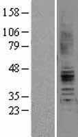 Angiotensin II Type 2 Receptor(AGTR2) (NM_000686) Human Tagged ORF Clone