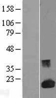Galectin 1(LGALS1) (NM_002305) Human Tagged ORF Clone
