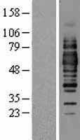 Occludin(OCLN) (NM_002538) Human Tagged ORF Clone