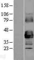 GJA1(GJA1) (NM_000165) Human Tagged ORF Clone