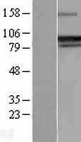 GADD34(PPP1R15A) (NM_014330) Human Tagged ORF Clone
