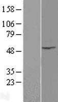 Integrin Linked Kinase(ILK) (NM_004517) Human Tagged ORF Clone